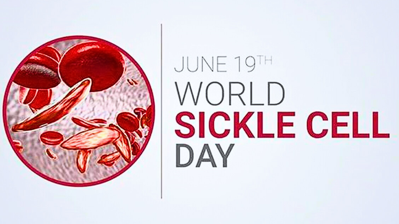 World Sickle Cell Day celebration will be held on June 19 at 10 am at Chandra Vijay Mahavidyalaya ground in Dindori.