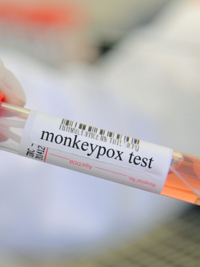 Monkeypox Test