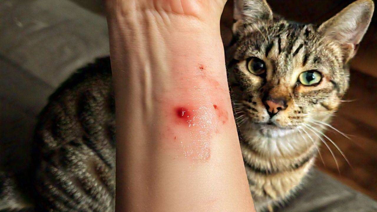 Cat bite cases increased in the state, 39 thousand cases came to light in 2 years