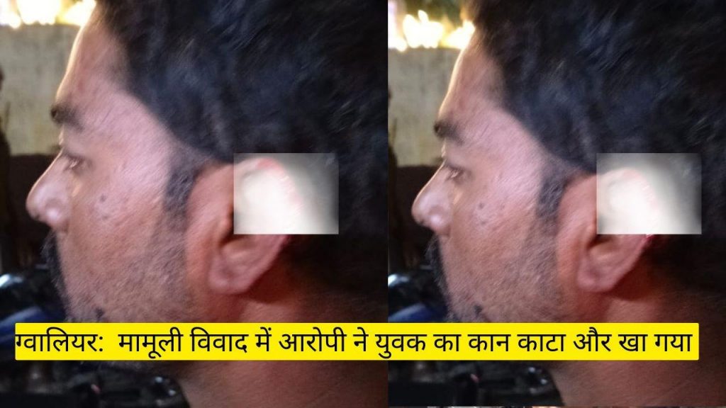 In Gwalior, the accused cut off the ear of a young man and ate it due to a minor dispute