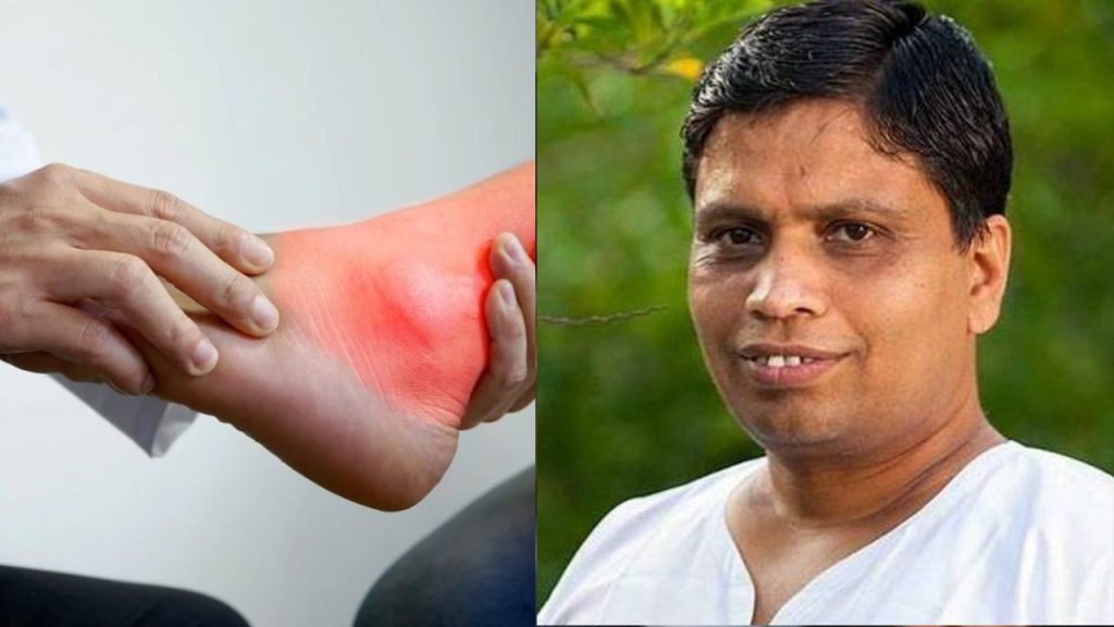 Acharya Balkrishna on uric Acid
