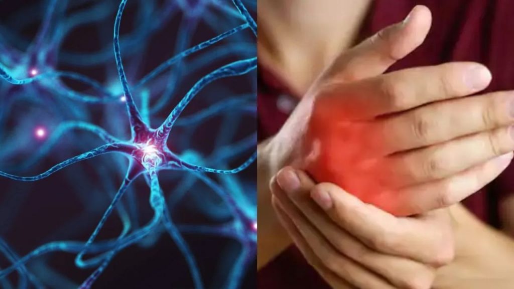 Guillain-Barre Syndrome