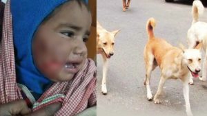 A two-year-old innocent was attacked by two dogs in Gwalior