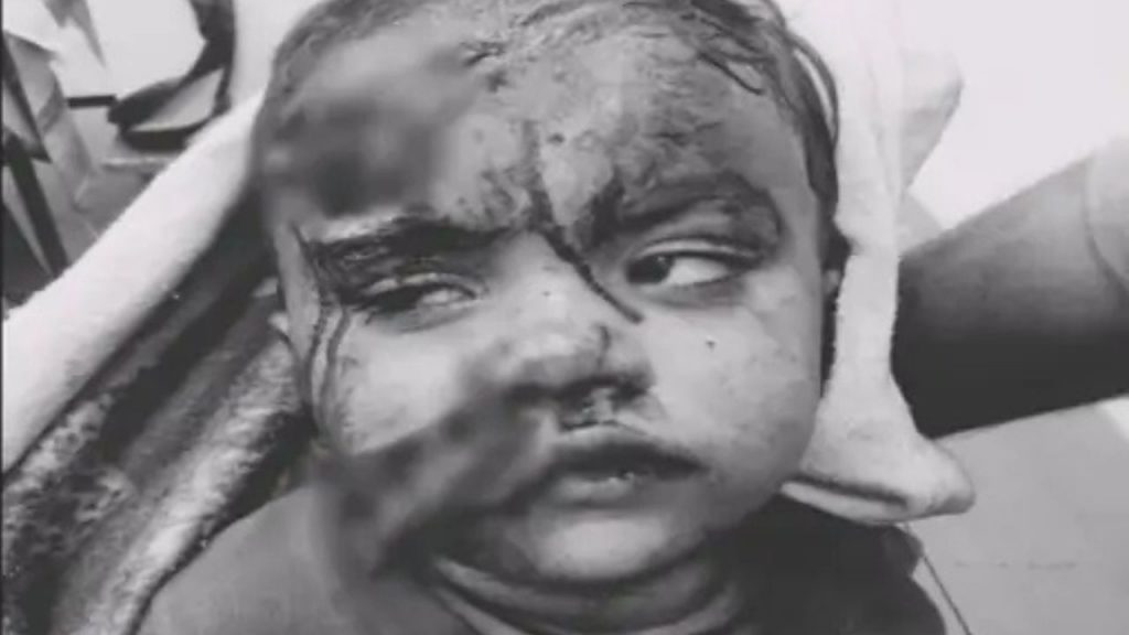 The mad dog caught the girl's head in its jaws.