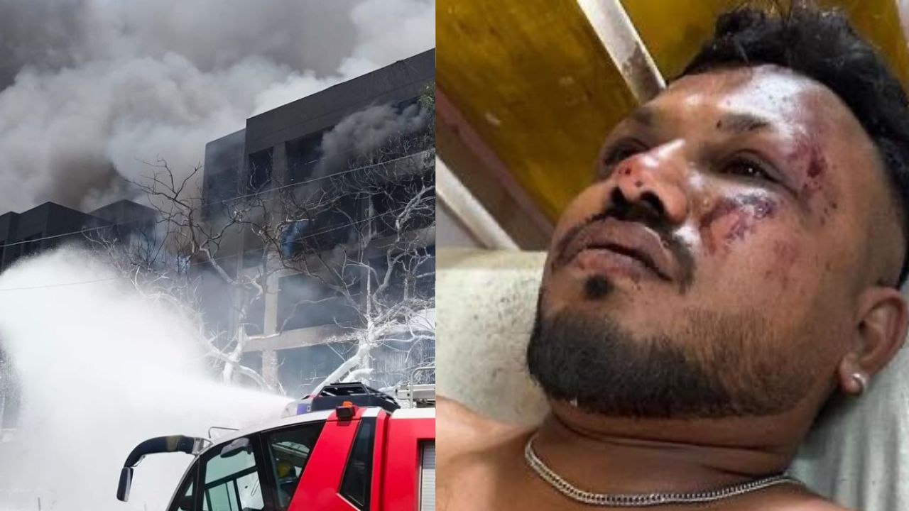 Ramesh Vishwas survived the Ahmedabad plane crash.