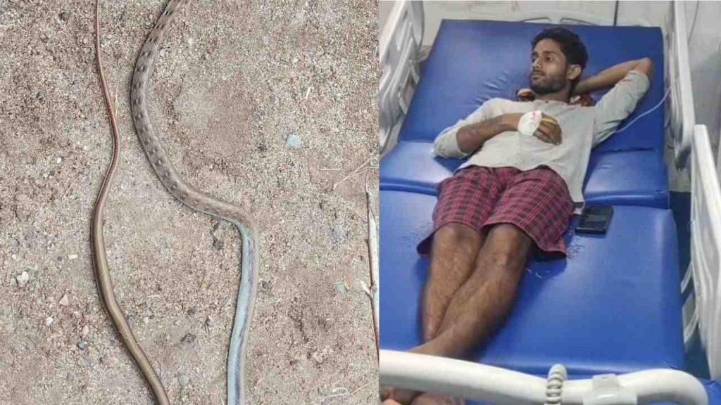 After the snake died, the young man was admitted to the hospital.
