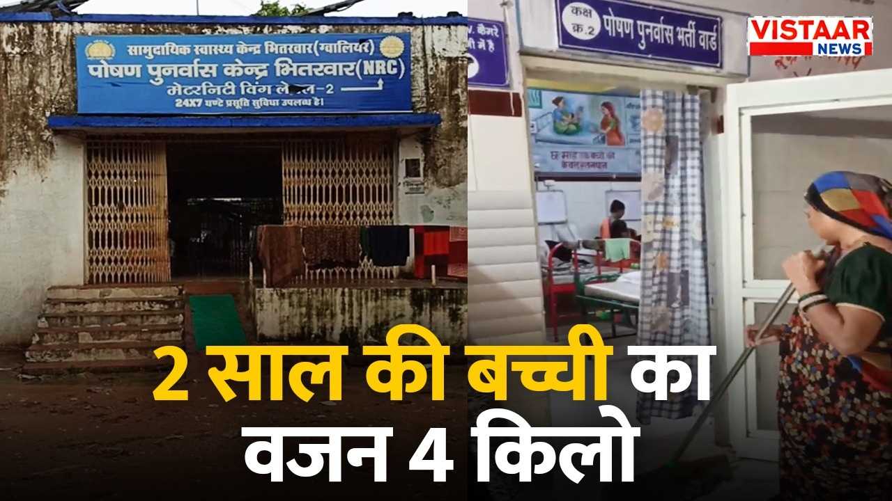 The girl suffering from malnutrition was admitted to the hospital.