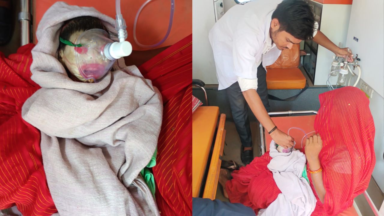 A deformed child was born in Rewa