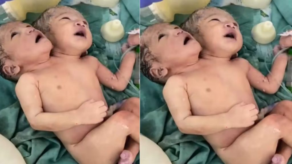 Indore two head girl born