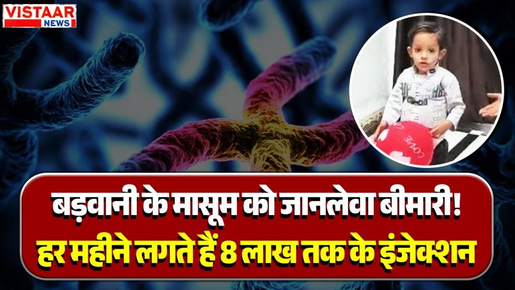 Five-year-old Mohammad Bilal from Barwani has a severe case of Gaucher disease.