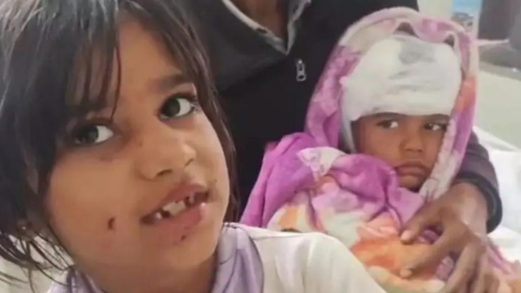 In Rajgarh, an 8-year-old girl fought with a dog to save her younger brother.