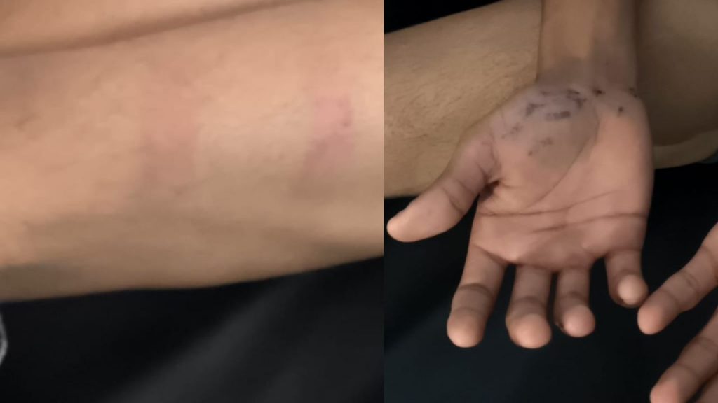 Hindu student brutally beaten in missionary school.