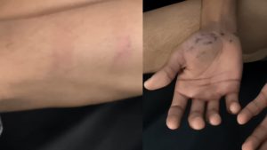 Hindu student brutally beaten in missionary school.