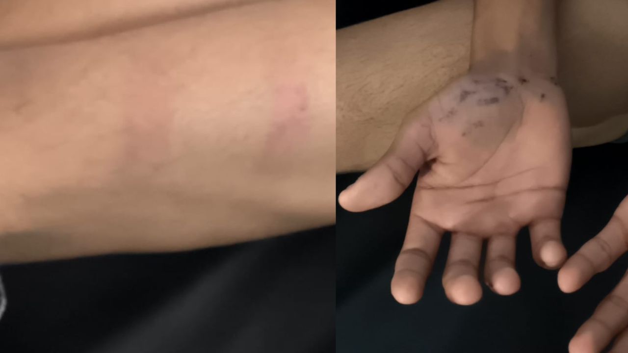 Hindu student brutally beaten in missionary school.