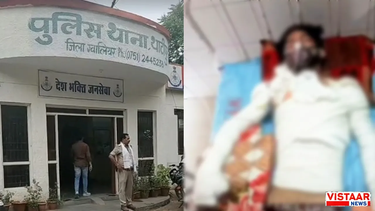 Young man badly burnt