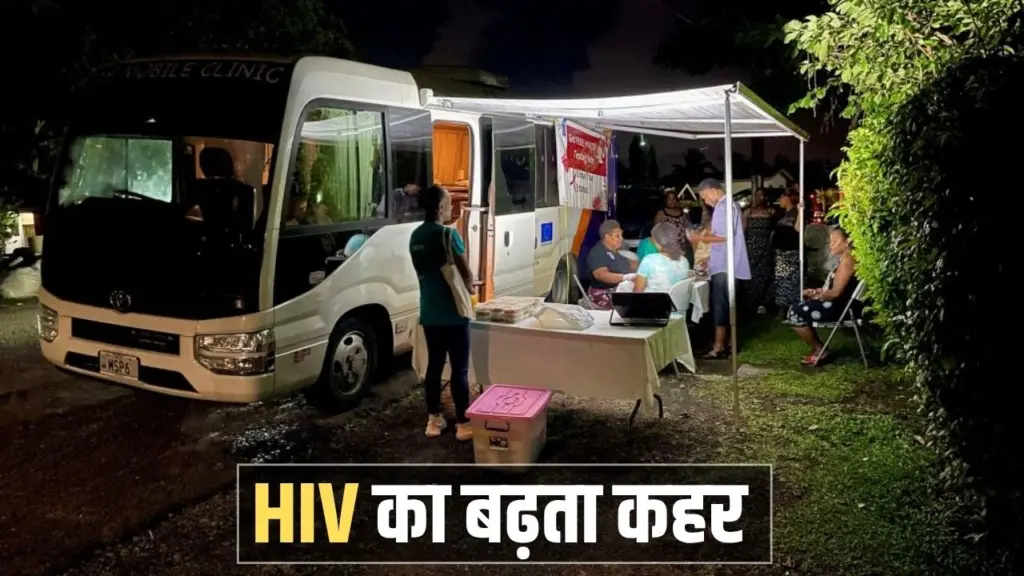 HIV AIDS