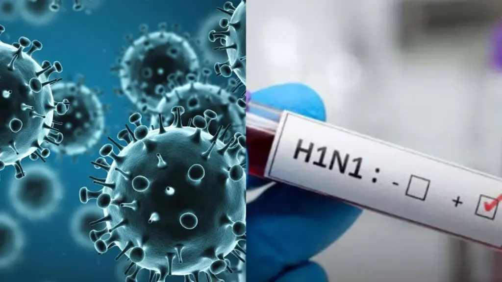 swine flu