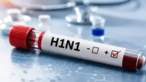 cg swine flu