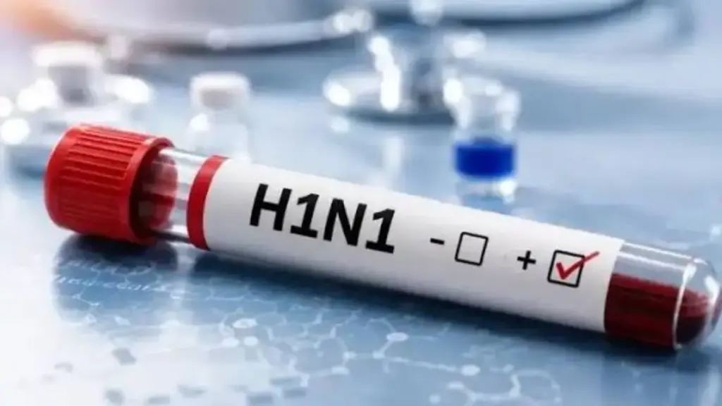 cg swine flu