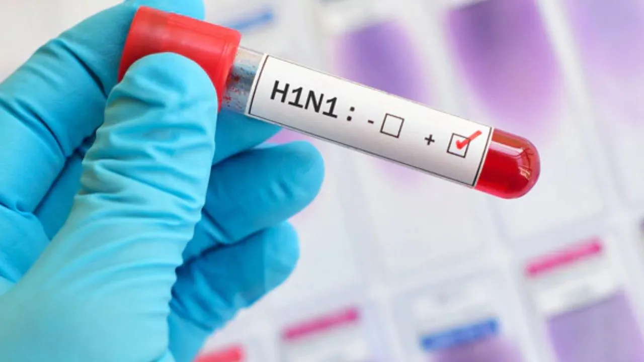 swine flu